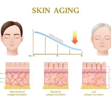 skin aging process anatomy layers during decrease collagen level realistic infographics vector illustration 1284 70493 1